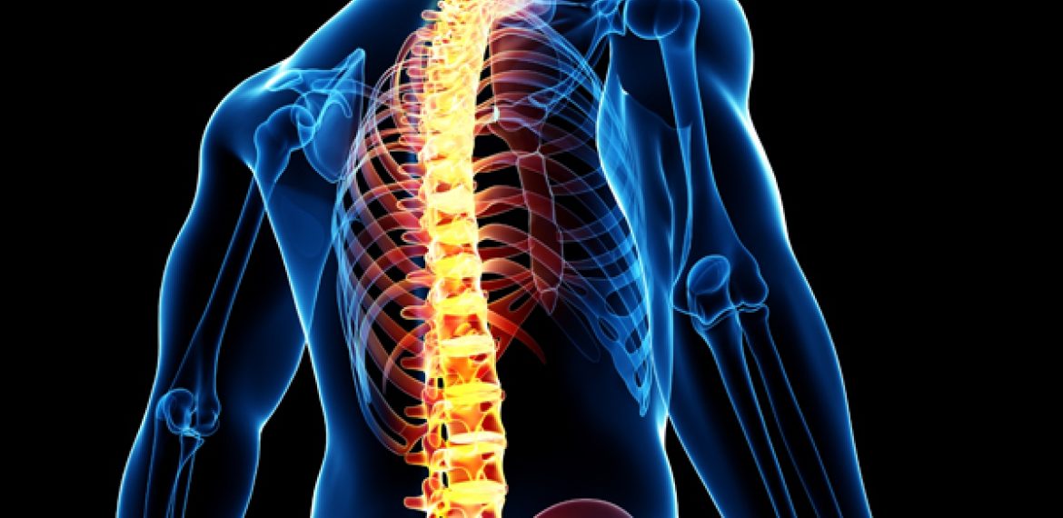Best Home Remedies to Treat Whiplash Injury