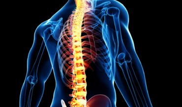 Best Home Remedies to Treat Whiplash Injury